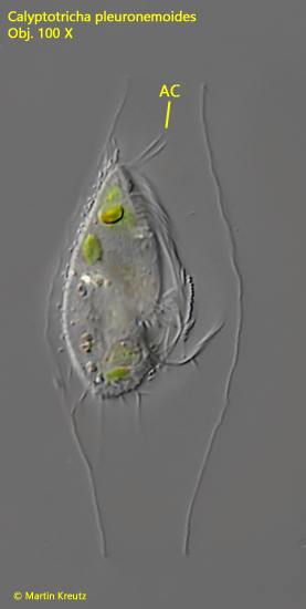 Calyptotricha-pleuronemoides