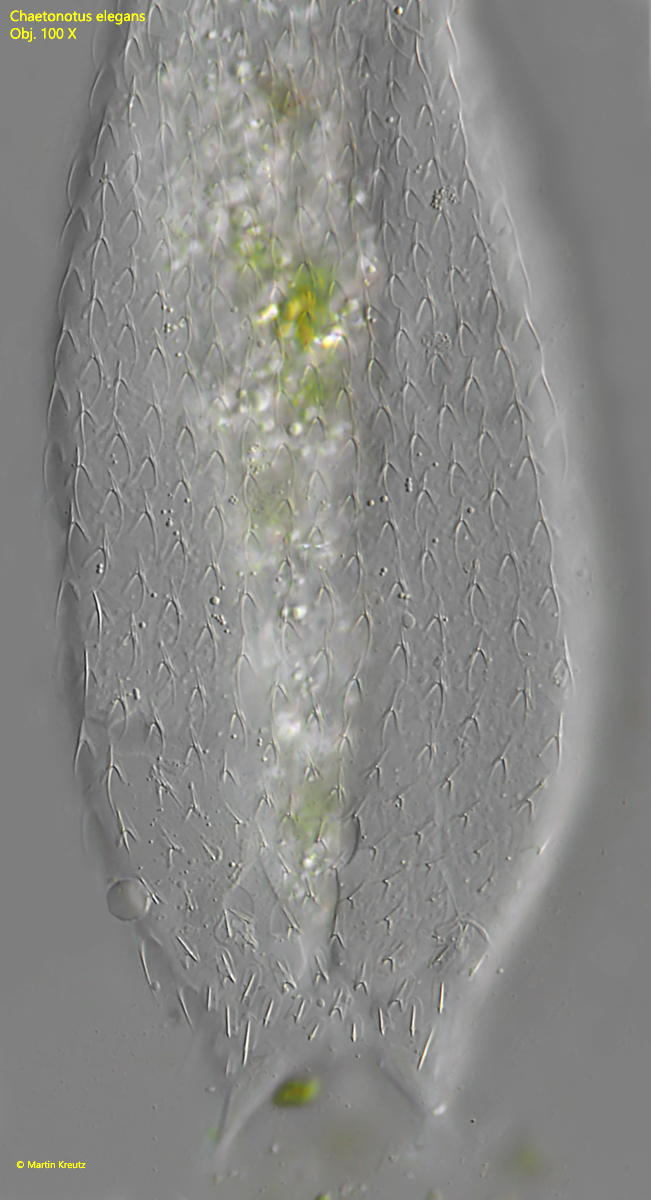 Chaetonotus-elegans