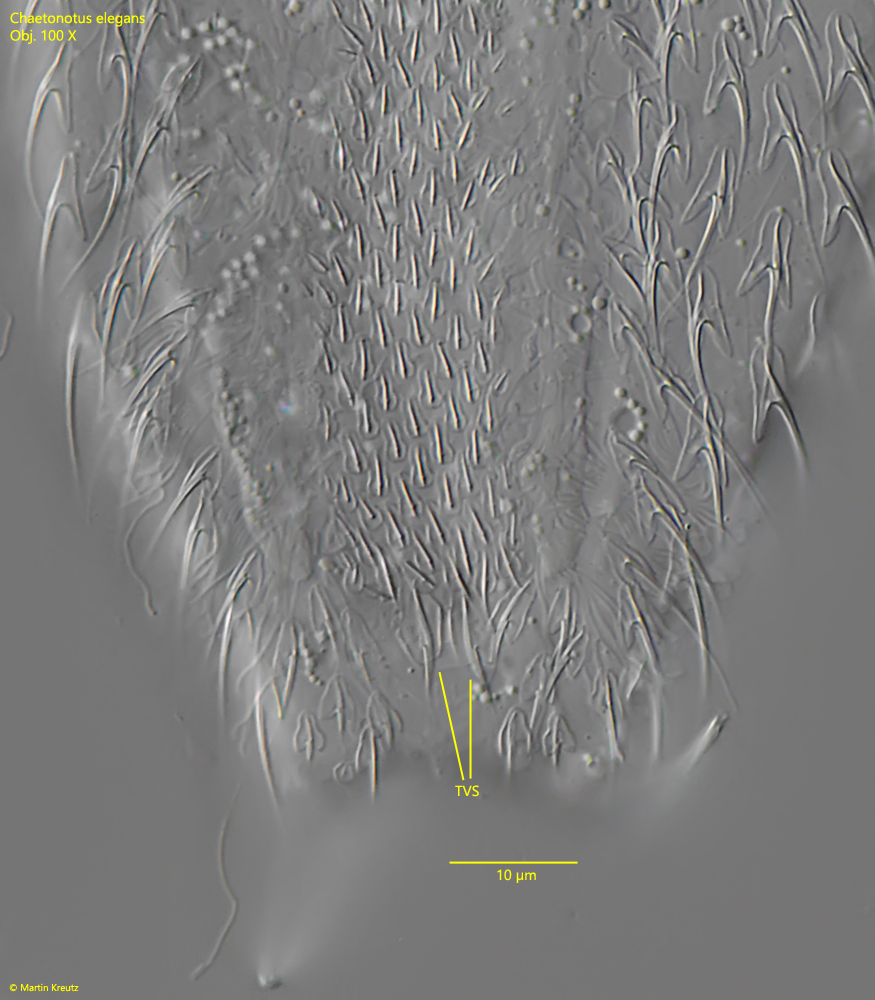 Chaetonotus-elegans