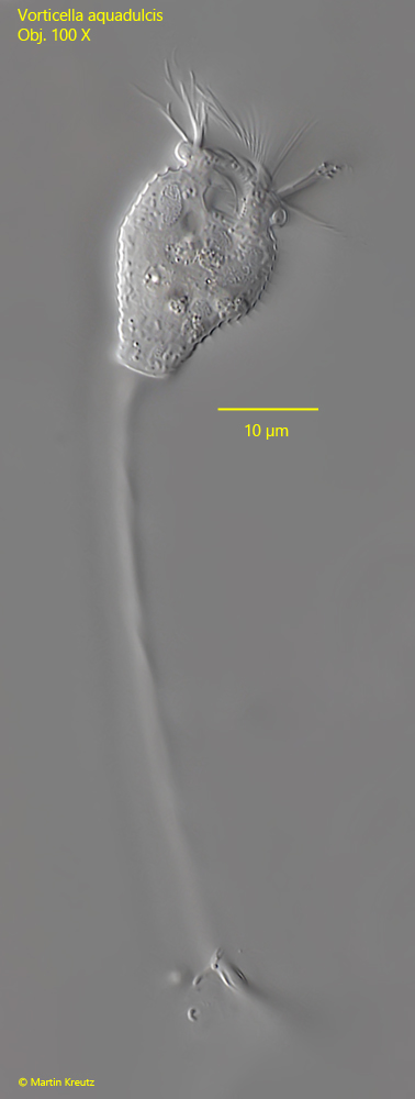 Vorticella-aquadulcis