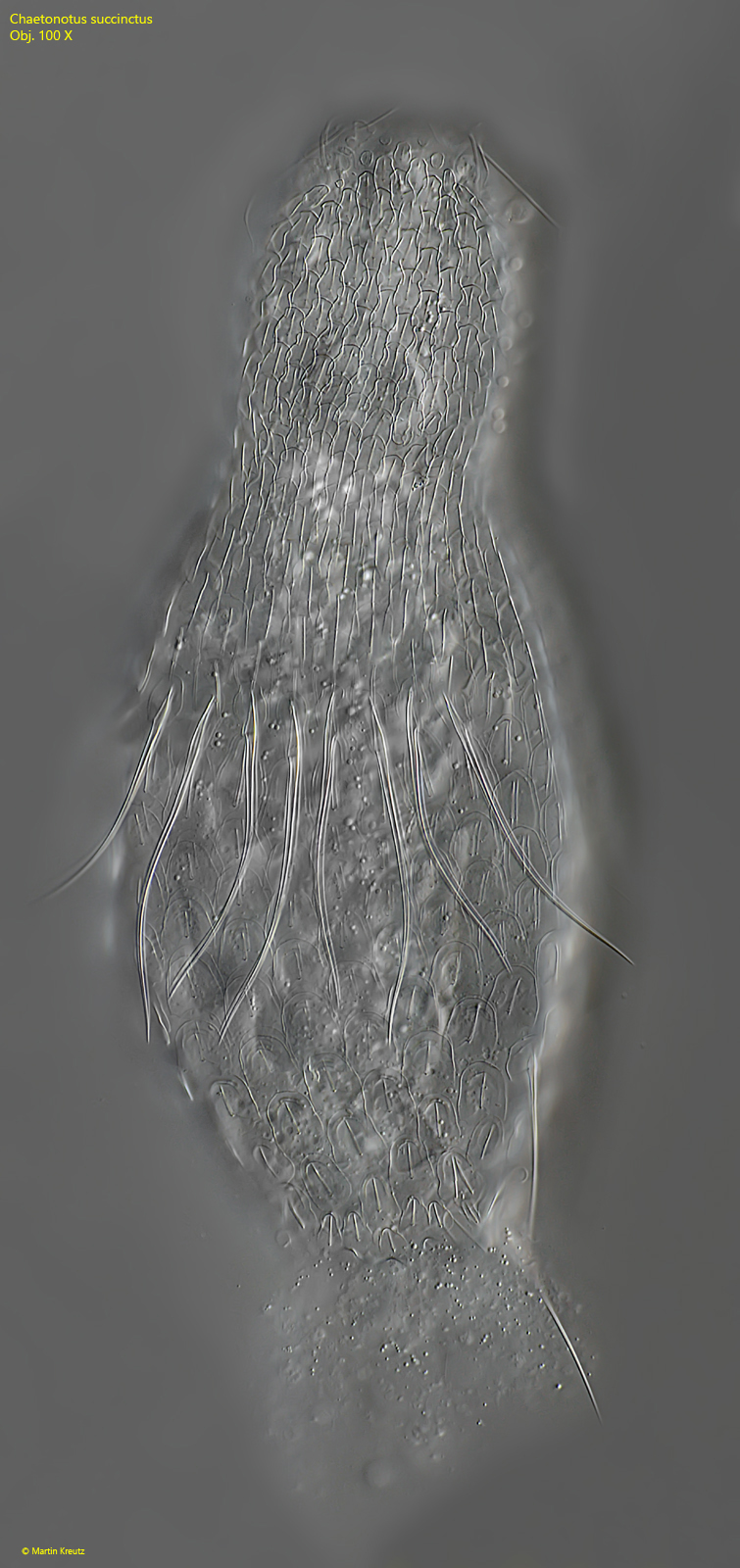 Chaetonotus-succinctus
