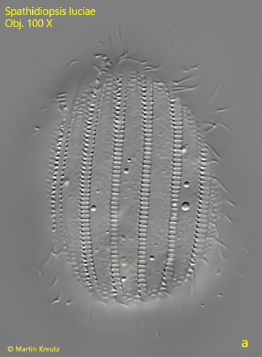 Spathidiopsis-luciae