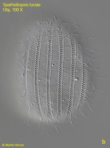 Spathidiopsis-luciae