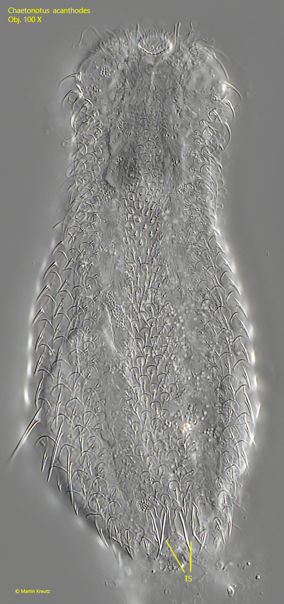 Chaetonotus-acanthodes