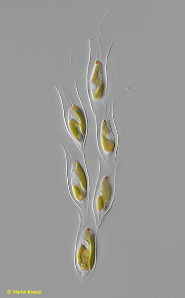 Dinobryon-sertularia