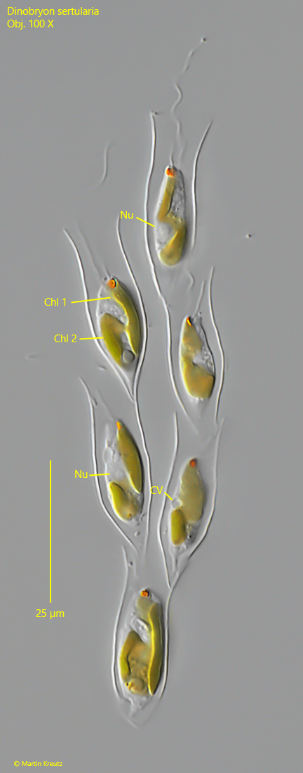 Dinobryon-sertularia