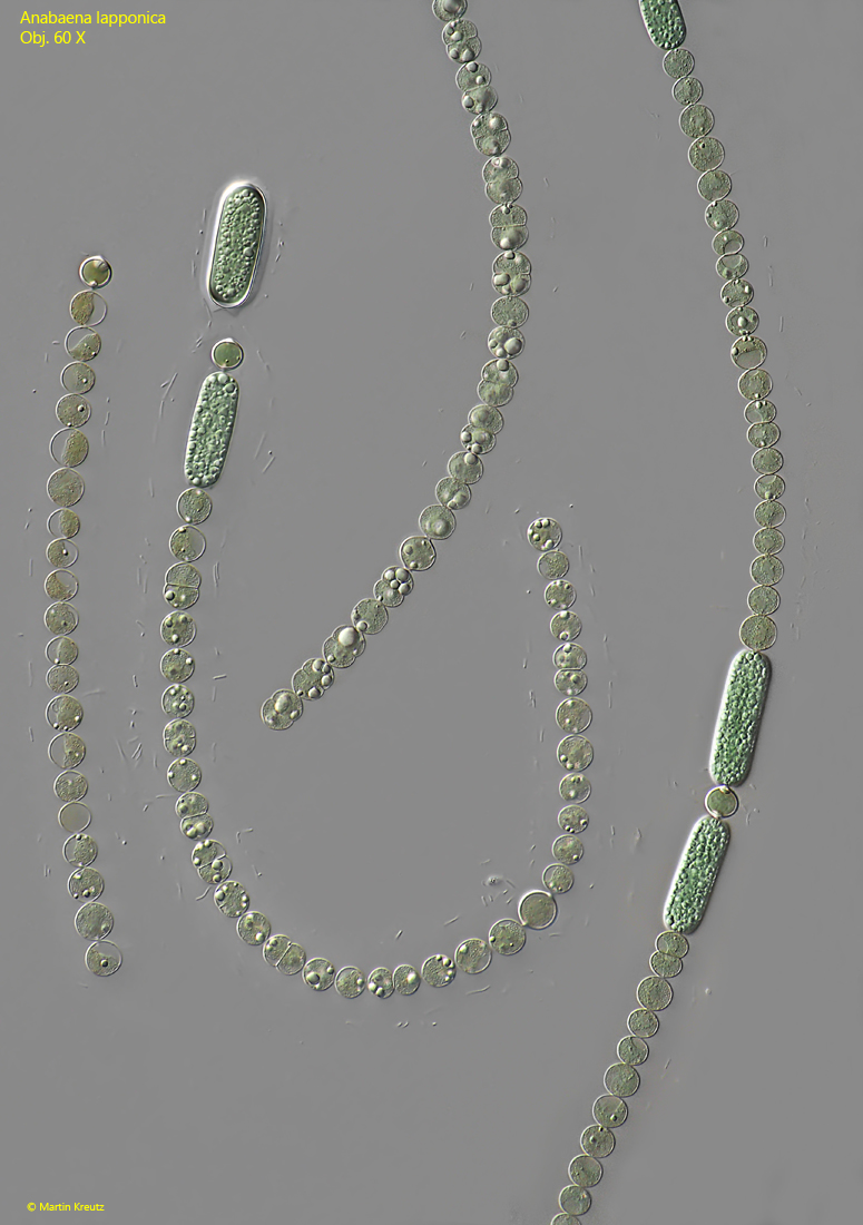Anabaena-lapponica