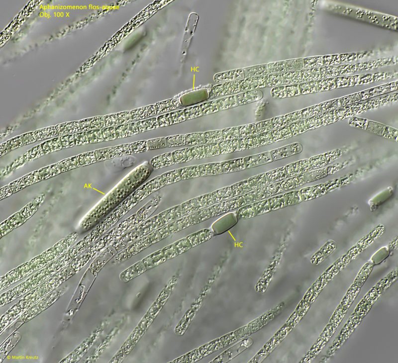 Netrium Digitus Aphanizomenon flos-aquae – Real Micro Life