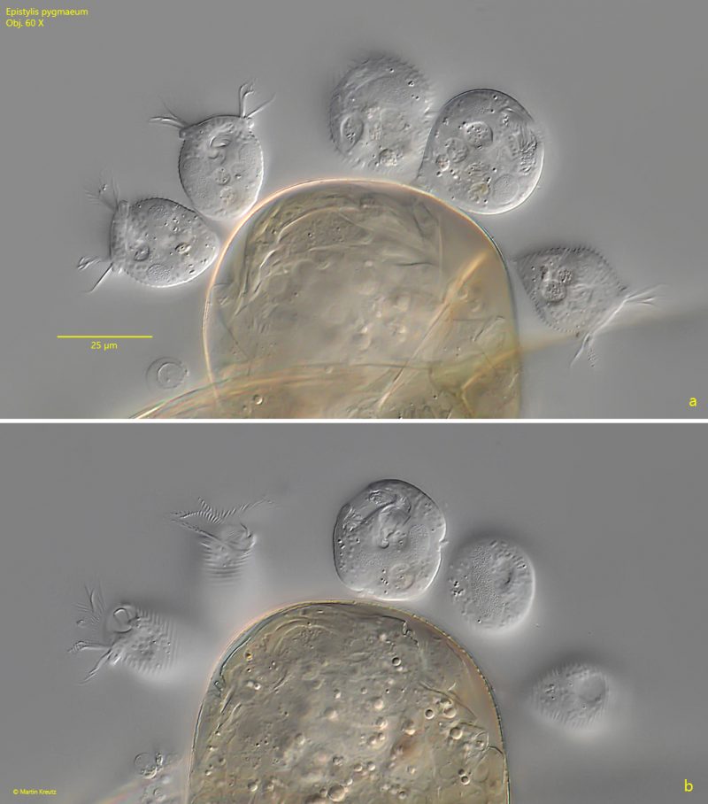 Epistylis pygmaeum – Real Micro Life