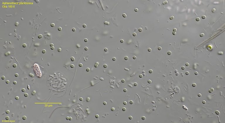 Aphanocapsa planctonica – Real Micro Life