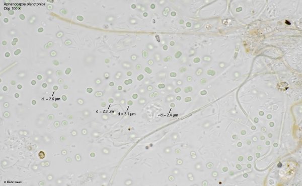 Aphanocapsa planctonica – Real Micro Life