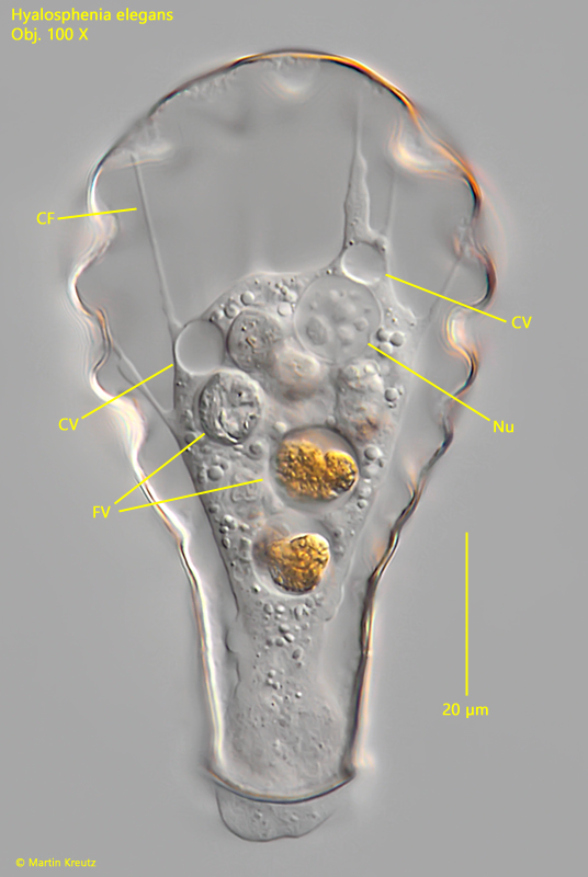 Hyalosphenia-elegans