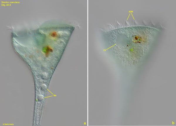 Stentor coeruleus – Real Micro Life