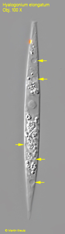 Hyalogonium-elongatum