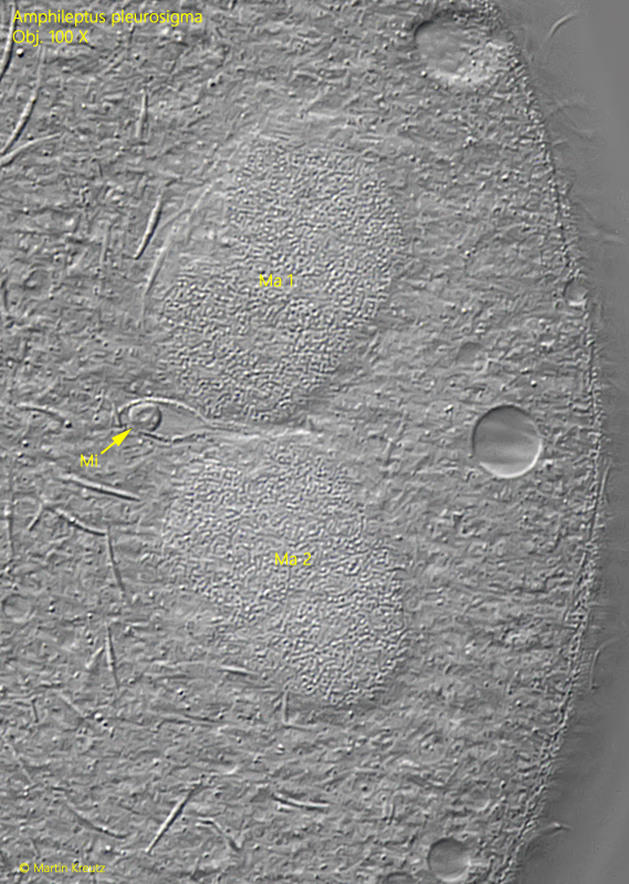 Amphileptus-pleurosigma