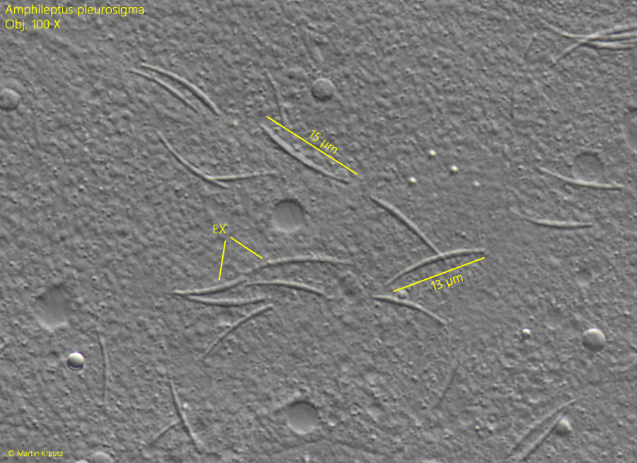 Amphileptus-pleurosigma