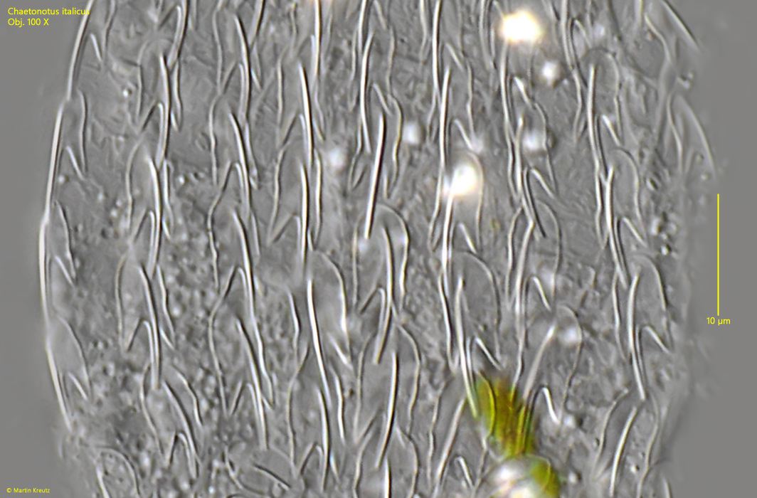 Chaetonotus-italicus