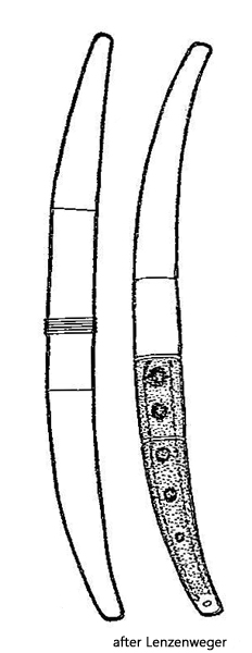 Closterium-abruptum