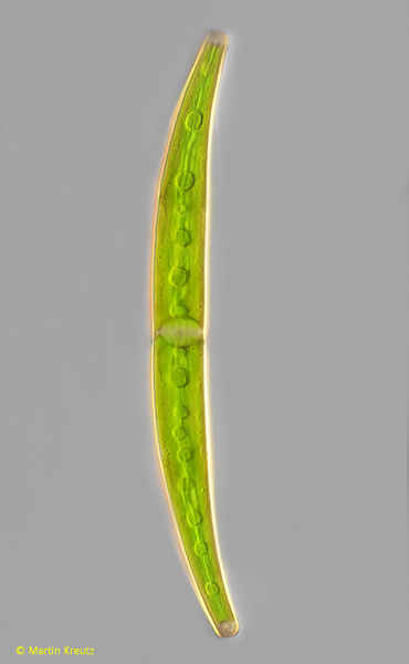 Closterium-abruptum