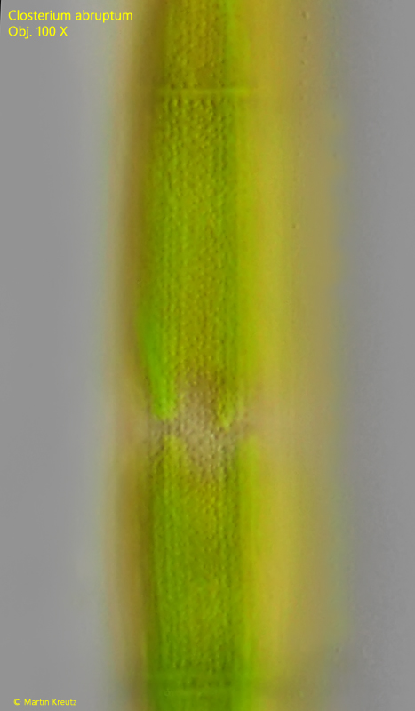 Closterium-abruptum