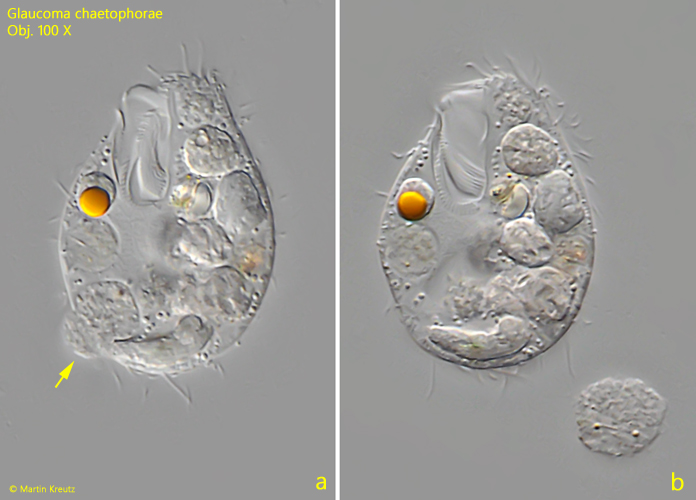 Glaucoma-chaetophorae