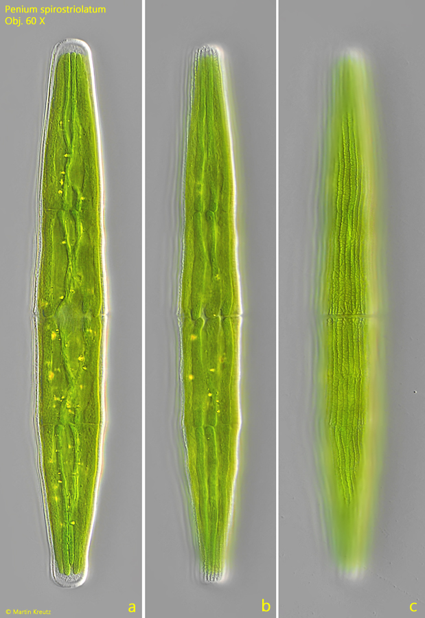 Penium-spirostriolatum