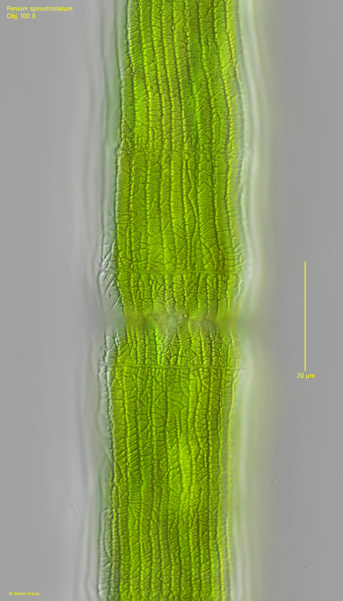 Penium-spirostriolatum
