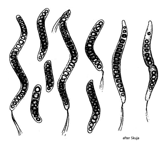 Thiospira-winogradskyi