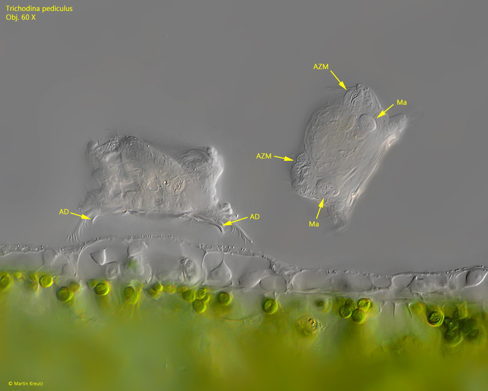 Trichodina-pediculus