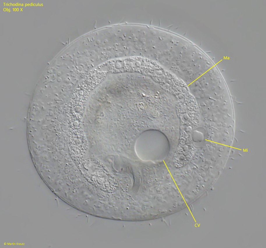 Trichodina-pediculus