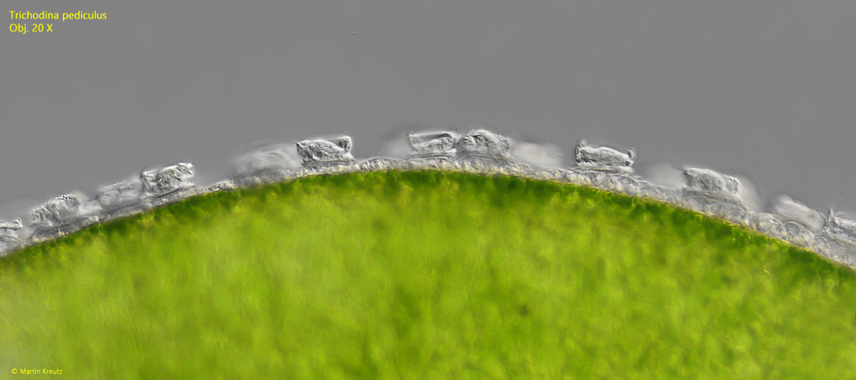 Trichodina-pediculus
