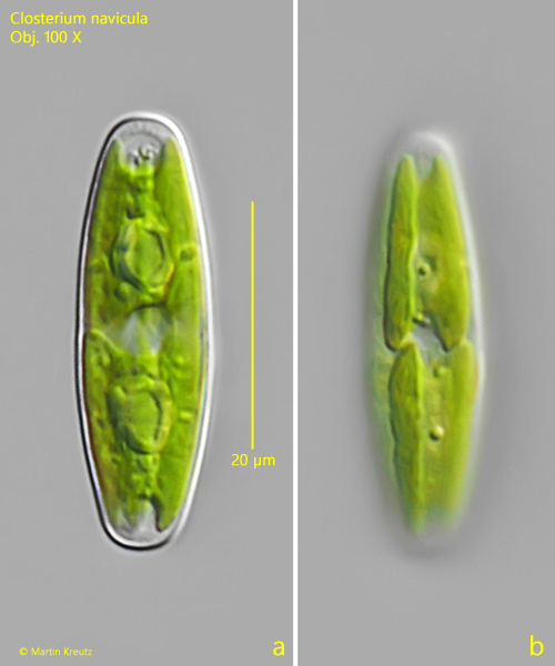 Closterium-navicula