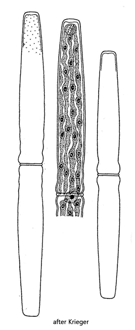 Pleurotaenium-trabecula