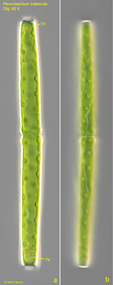 Pleurotaenium-trabecula