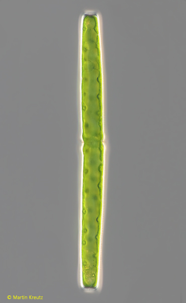 Pleurotaenium-trabecula