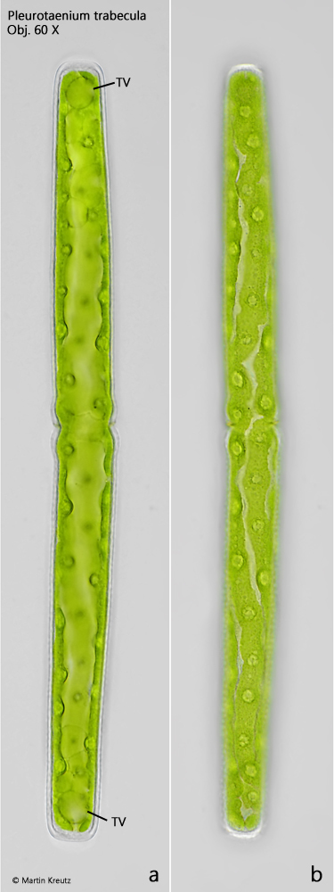 Pleurotaenium-trabecula