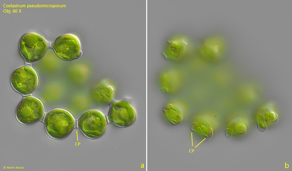 Coelastrum-pseudomicroporum