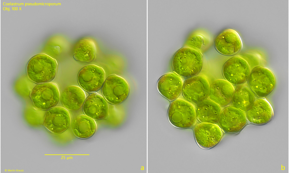 Coelastrum-pseudomicroporum