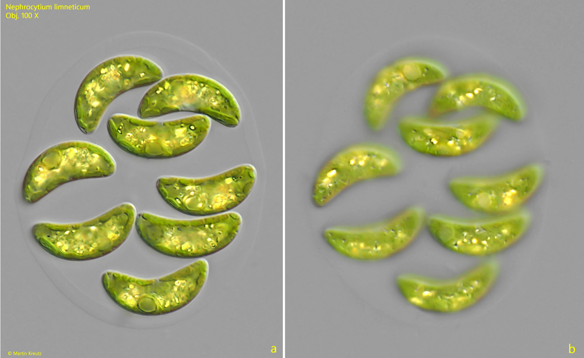 Nephrocytium-limneticum