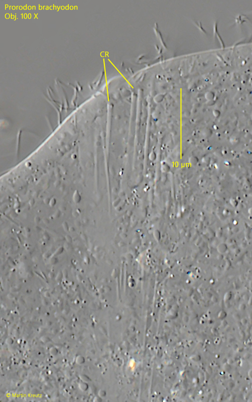 Prorodon-brachyodon