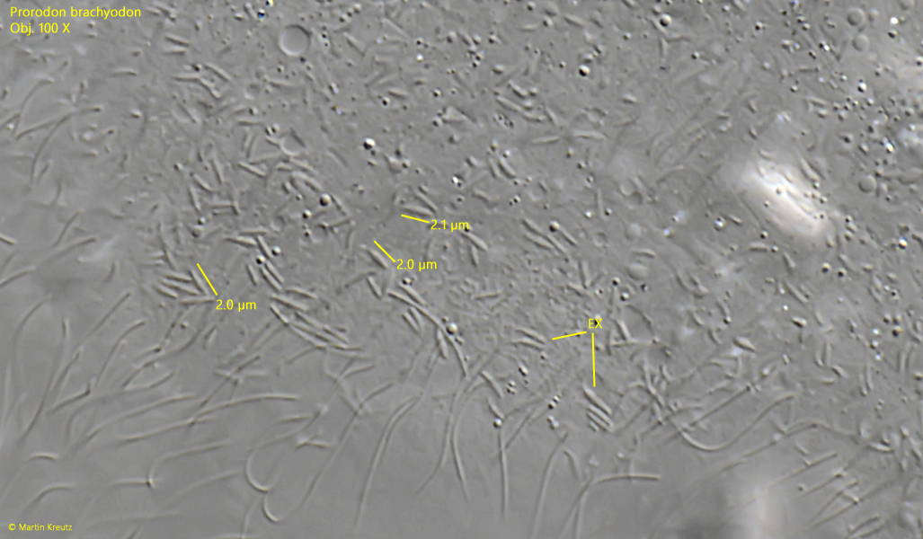 Prorodon-brachyodon