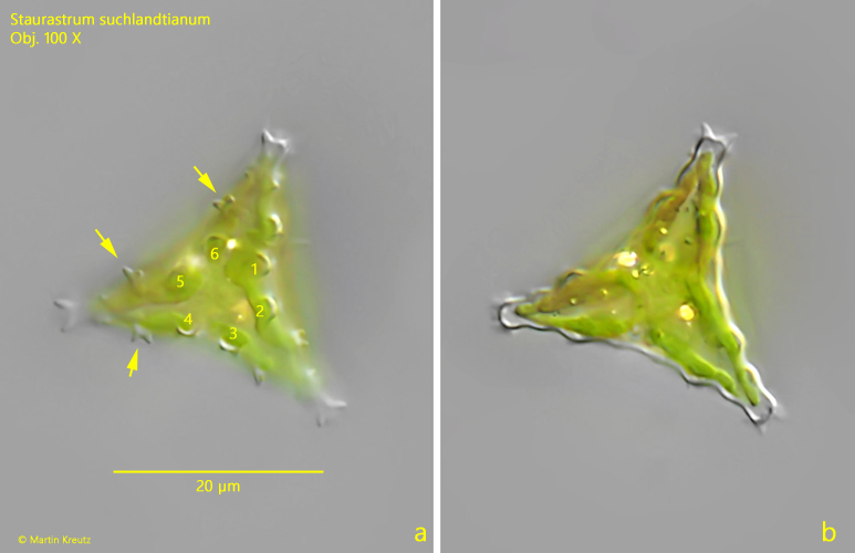 Staurastrum-suchlandtianum