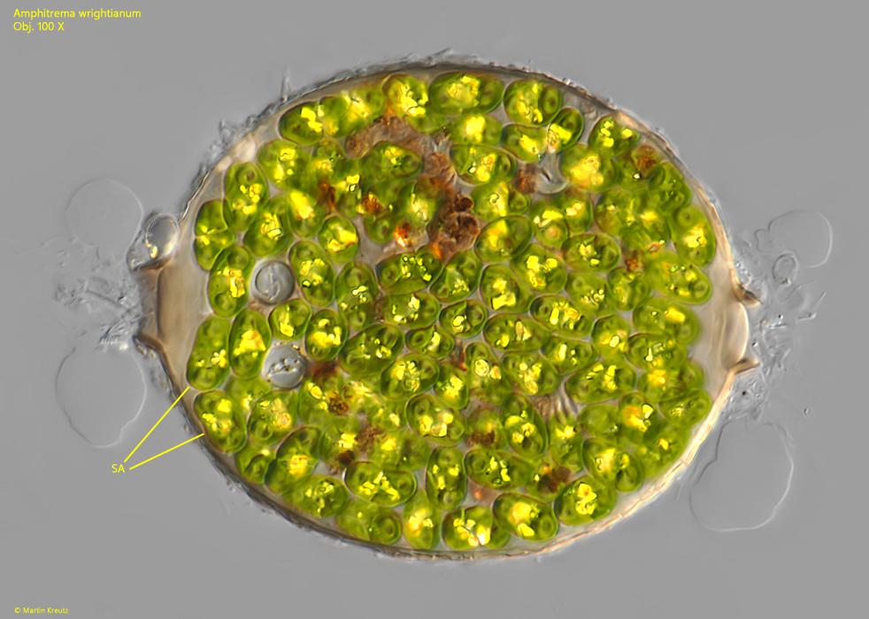 Amphitrema-wrightianum