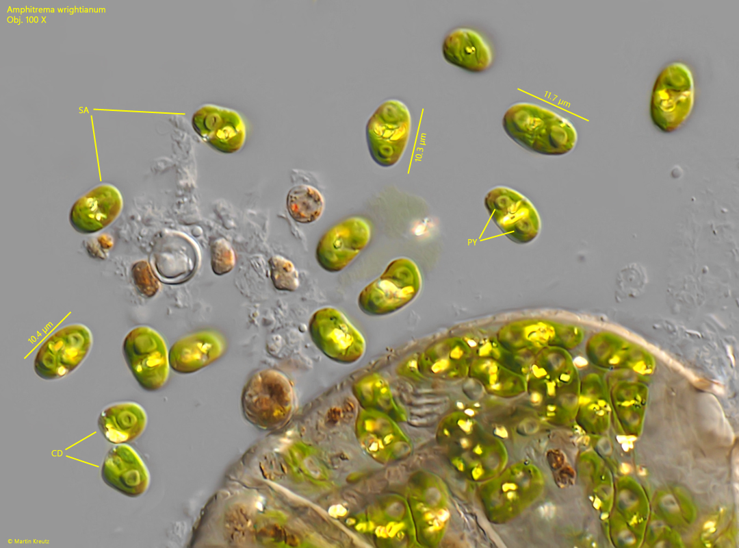 Amphitrema-wrightianum