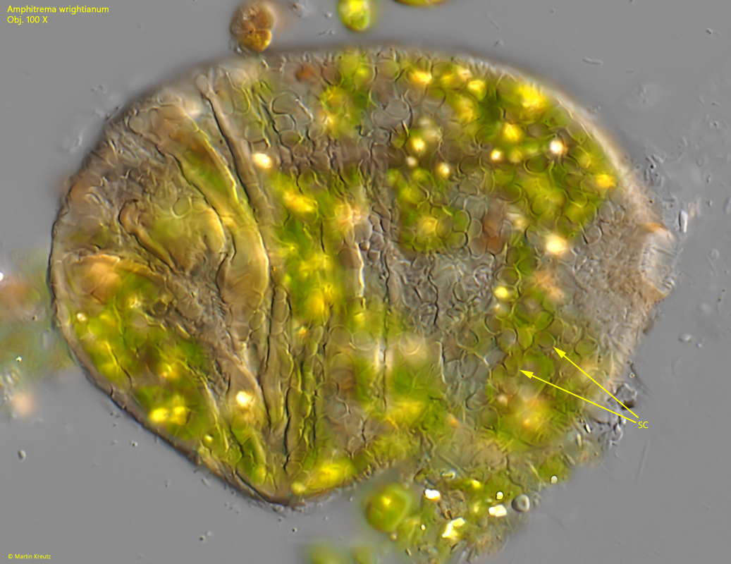 Amphitrema-wrightianum