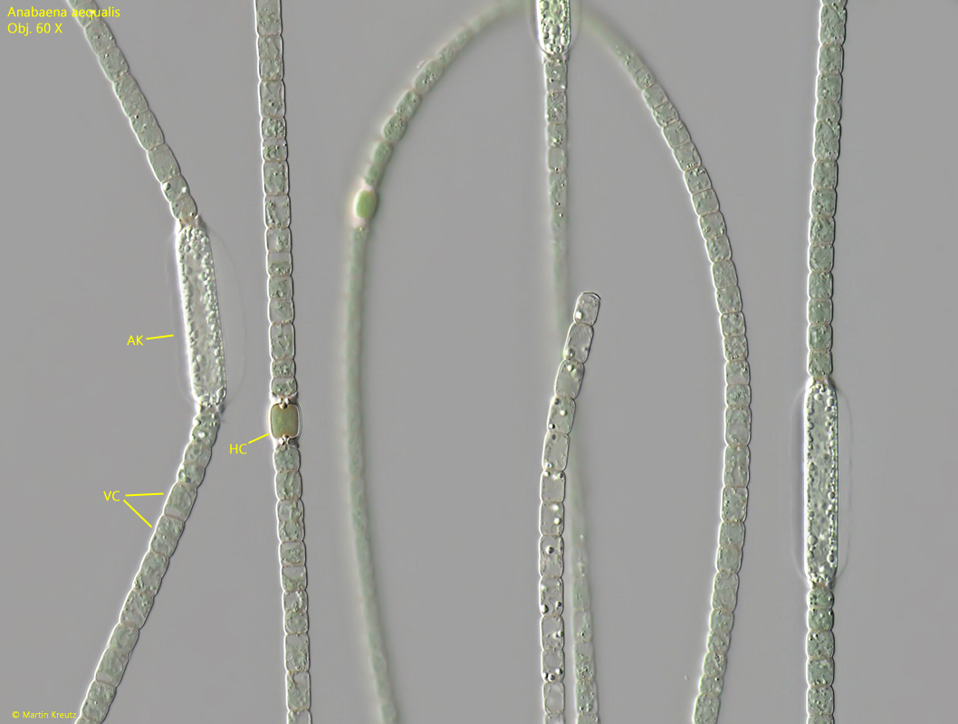 Anabaena-aequalis