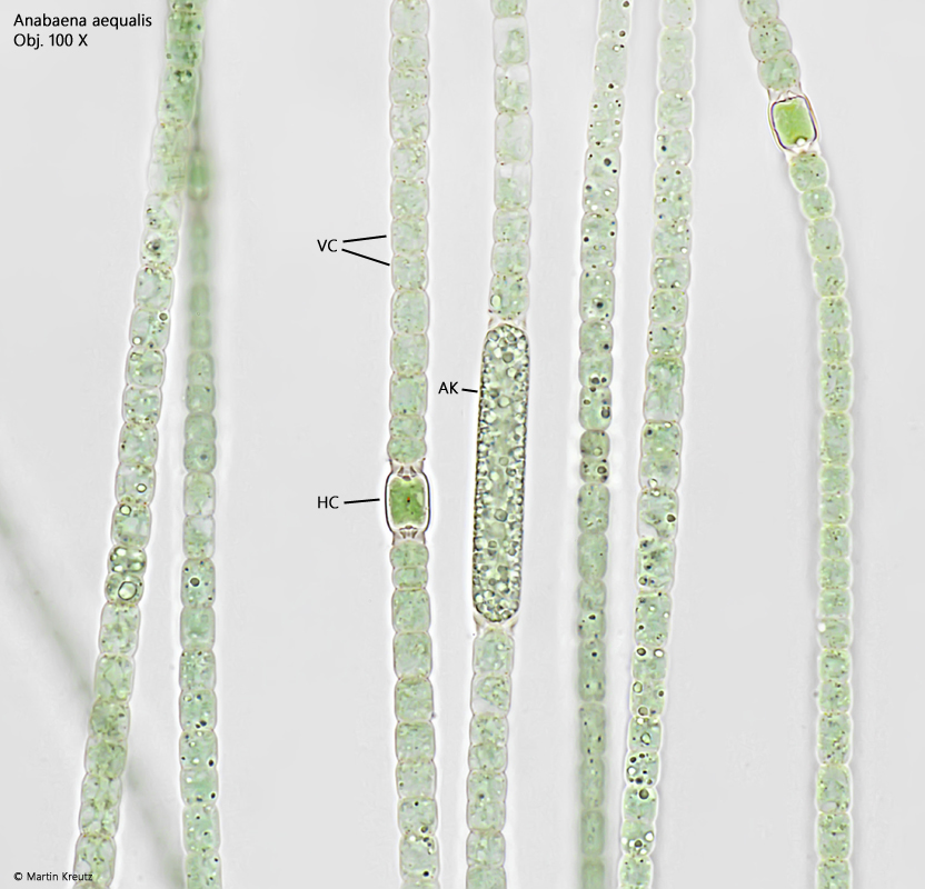 Anabaena-aequalis