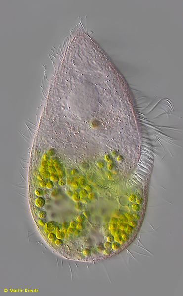 Blepharisma-coeruleum