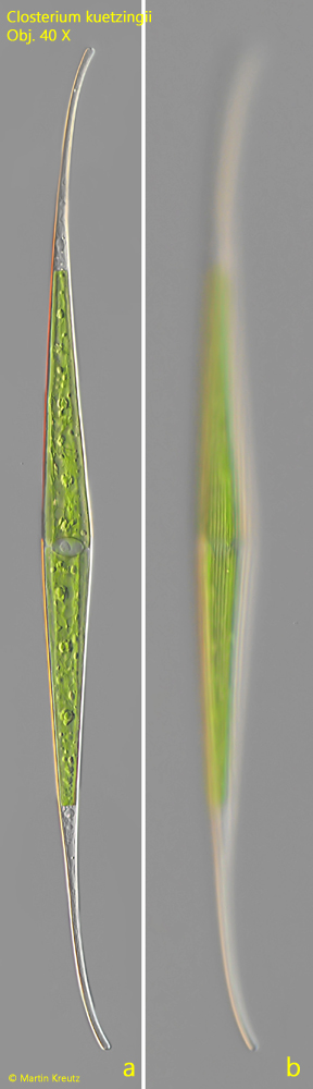 Closterium-kuetzingii