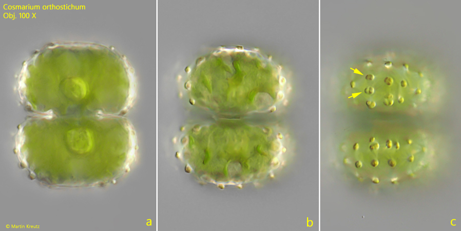 Cosmarium-orthostichum